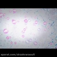 تاریخچه ای وی اف برای درمان ناباروری