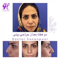 عمل جراحی توسط  دکتر حسن پور