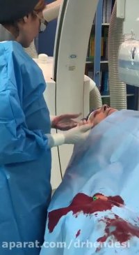 جواب آنژیوگرافی نرمال برای بیمار قلبی