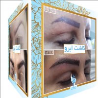 کاشت ابروی طبیعی با بروز ترین روش های روز دنیا