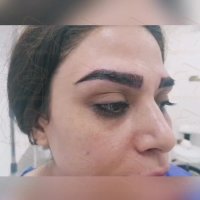 نظرات مردم در در مورد مرکز کاشت مو و ابرو رنسانس