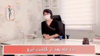 رضایت از کاشت ابرو دکتر فرشته جلالپور