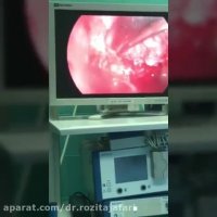 جراحی مننژیوم قاعده جمجمه