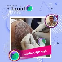 جراحی کاشت مو