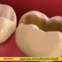 ترمیم و پر کردن دندان