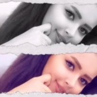 جراحی بینی عروسکی