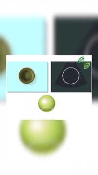 فیلم سونوگرافی دوران بارداری با توضیحات دکتر جورابیان