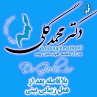 نمونه بینی مردانه | دکتر گلی جراح بینی تهران
