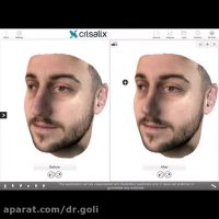 طراحی سه بعدی بینی مردان