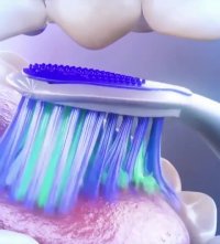 بهداشت دهان و دندان-دکترمجیدقیاسی بهترین جراح و دندانپزشک زیبایی درمشهد