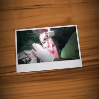 عمل اصلاح زانوی پرانتزی