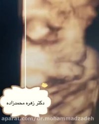 سونوگرافی جنین
