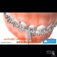 متخصص ارتودنیی در غرب تهران