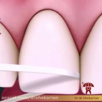 نحوه صحیح استفاده از نخ دندان