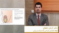 توضیحات دکتر آرمان انقطاع درمورد پروتز سینه