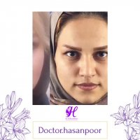 نمونه جراحی بینی و میزان رضایتمندی مراجعین