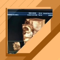 سونوگرافی چهار بعدی کل بدن جنین