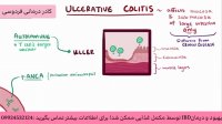 درمان التهاب روده به صورت کامل بدون بازگشت
