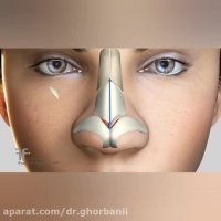 نحوه تغییر نوک بینی