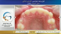 بهترین متخصص ارتودنسی تهران | دکتر داوودیان