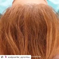 اسکالپ از دیدگاه مراجعه کننده به مرکز تخصصی اسکالپ آیرملو