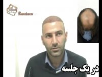 نظرات مراجعین مرکز تخصصی مو رنسانس