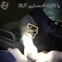 کاشت مو | کلینیک تخصصی رنسانس  02122088210