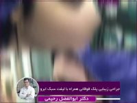 فیلم جراحی زیبایی پلک بالا