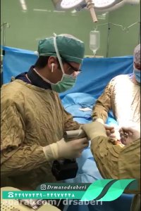 اصلاح زانوی پرانتزی | دکتر مسعود صابری متخصص ارتوپد و جراح تعویض مفصل زانو و ران