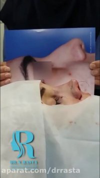 فیلم واقعی جراحی بینی