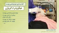 فیلم جوانسازی پوست با میکرودرم ابریژن توسط دکتر ایمان روغنی