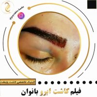 کاشت ابرو روی تتو و هاشور | کلینیک پایتخت | 44228594-021