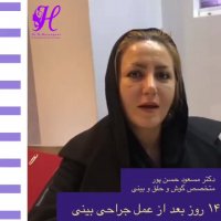 عمل انجام شده توسط دکتر حسن پور