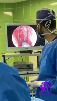 فیلم جراحی آندوسکوپی سینوس