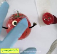 ویدیو جالب وشماتیک از زایمان سزارین