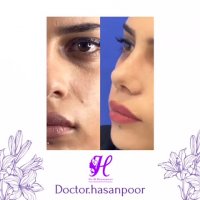 نمونه کار دکتر حسن پور