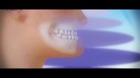 ارتودنسی دندان-مرکز دندانپزشکی فوق تخصصی ایمپلنت پردیس www.pardisdental.ir