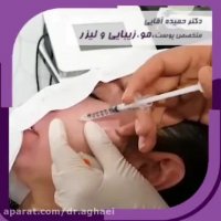 جوانسازی پوست با مزوتراپی صورت