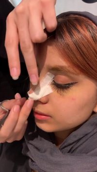 فیلم چسب زدن به بینی بعد از عمل