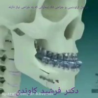 مراحل ارتودنسی و جراحی فک