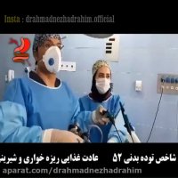 مینی بای پس در خانم 38 ساله