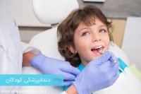 آرمه تخفیف پارسیان