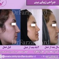 بخشی از نمونه جراحی های دکتر اسماعیل فرزاد فرد