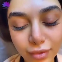 پیگمنتیشن در کلینیک ارکیده