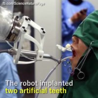 دندانپزشک ربات!