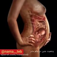 وضعیت جنین در شکم مادر