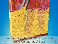 انیمیشن برداشتن چربی جهت تزریق (بخش 2)