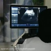 فیلم زایمان طبیعی در تهران