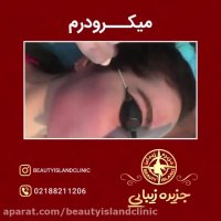 نمونه کار میکرونیدلینگ -کلینیک جزیره زیبایی