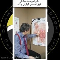 آنچه در مورد کیسه صفرا باید بدانید!